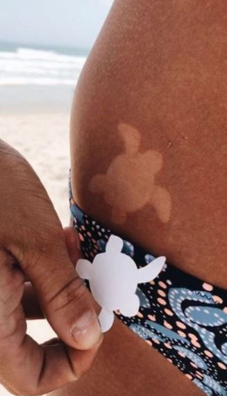 Дерматолог: "солнечные татуировки" опасны для здоровья